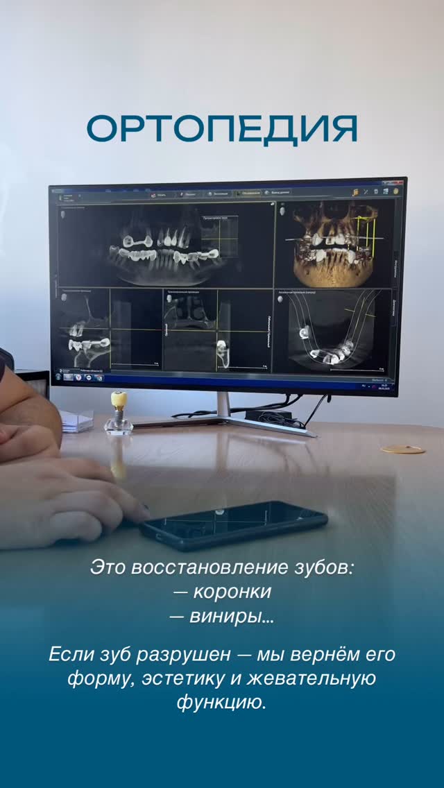 Отбеливание зубов