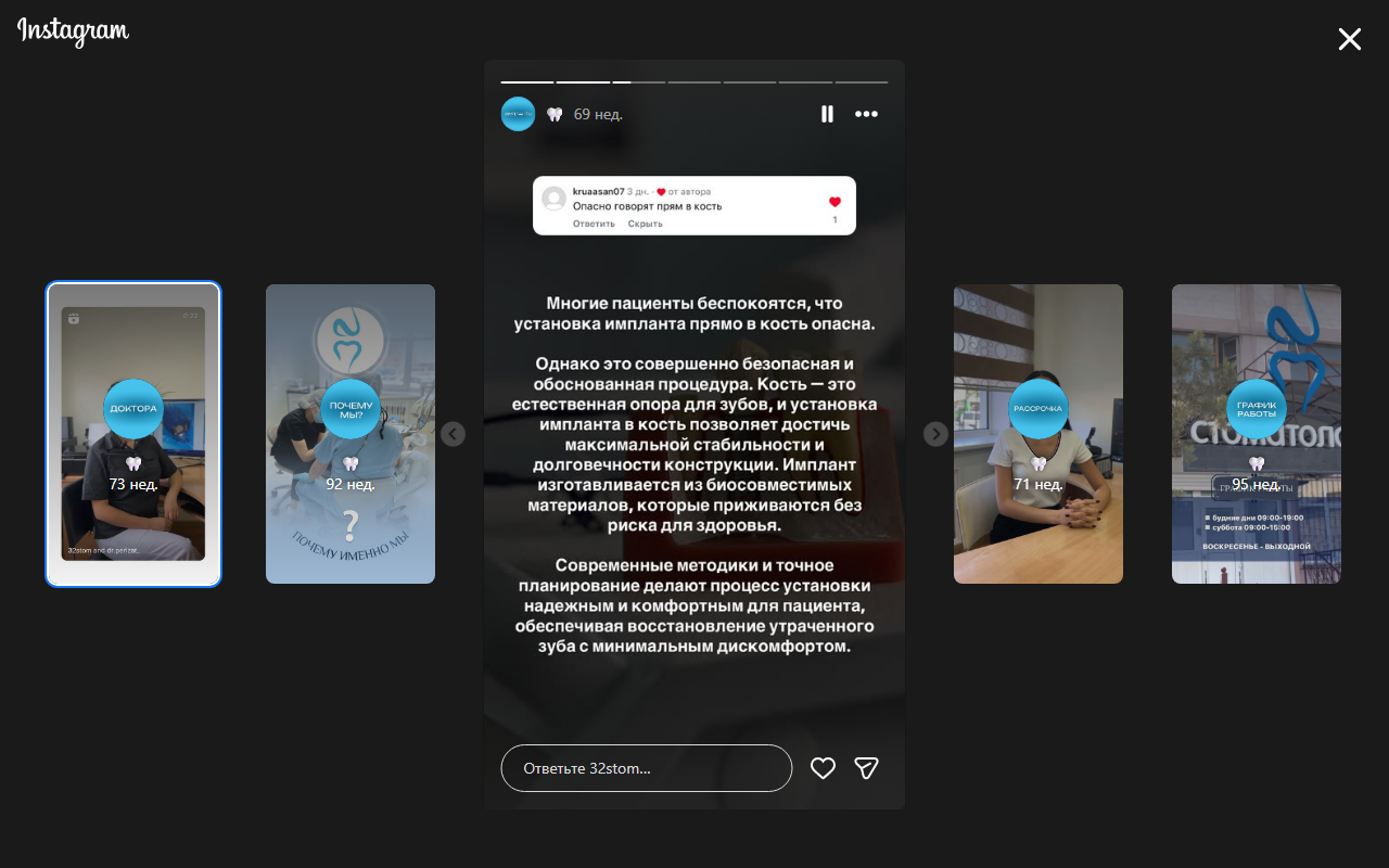 Имплантация — материалы