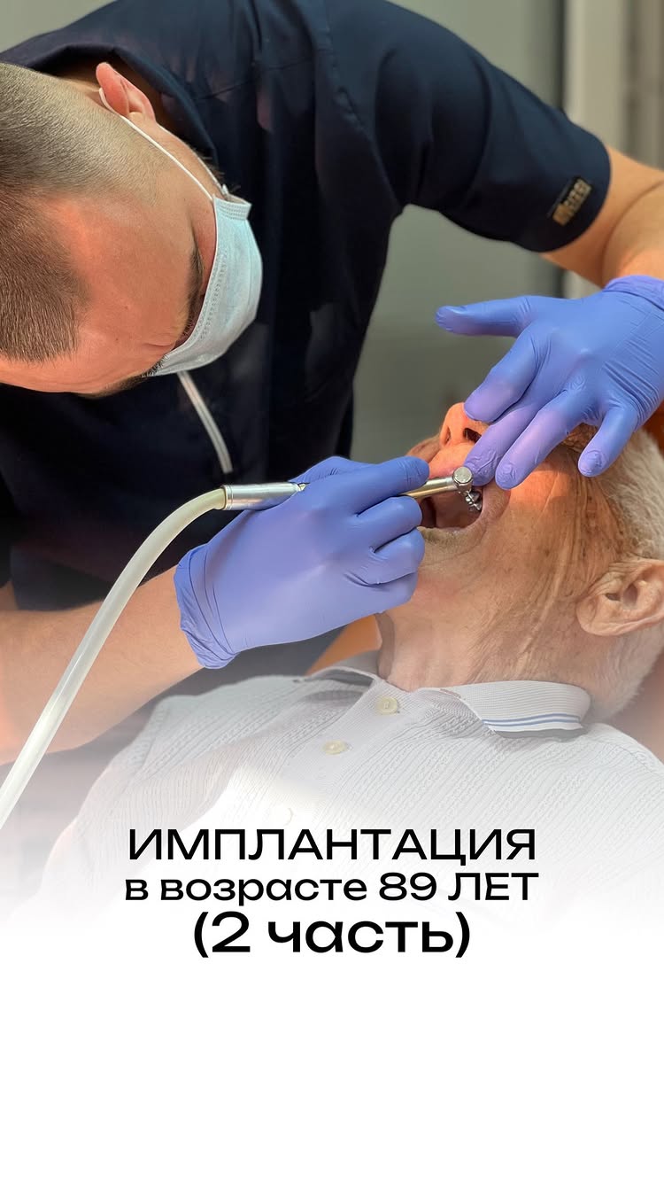 3D томография диагностика